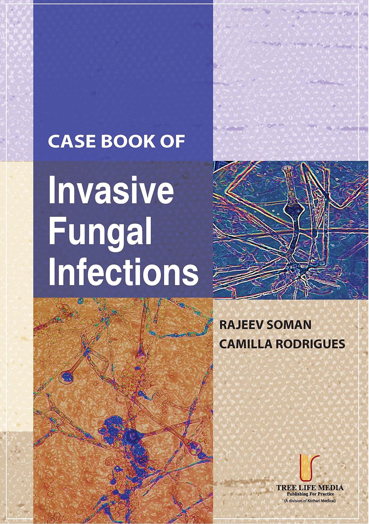 Case Book of Invasive Fungal Infections - Retail Maharaj