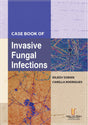 Case Book of Invasive Fungal Infections - Retail Maharaj