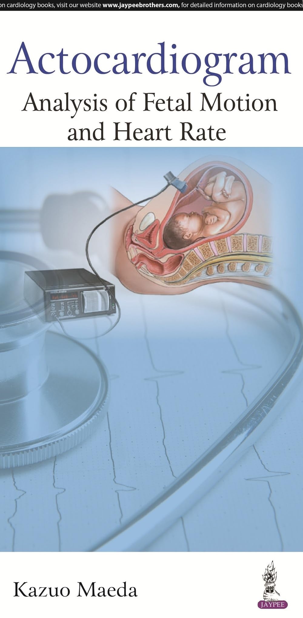 ACTOCARDIOGRAM:ANALYSIS OF FETAL MOTION AND HEART RATE - Retail Maharaj