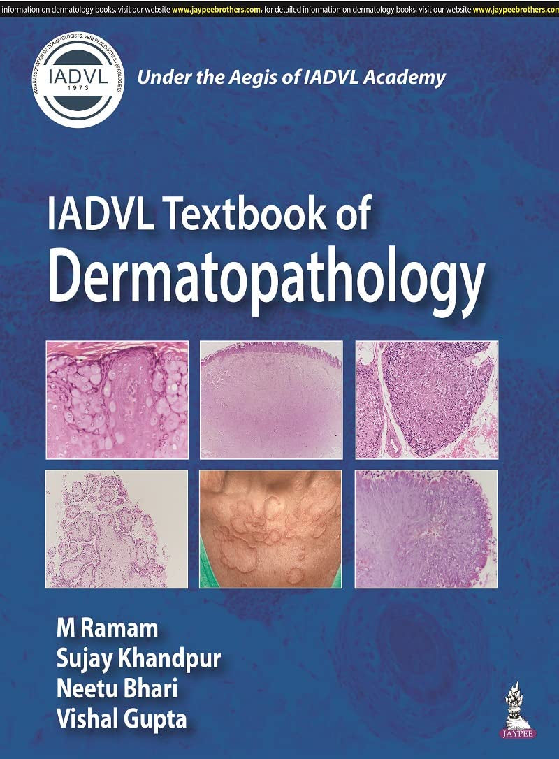 IADVL Textbook of Dermatopathology - Retail Maharaj