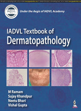 IADVL Textbook of Dermatopathology - Retail Maharaj