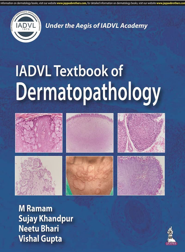 IADVL Textbook of Dermatopathology - Retail Maharaj