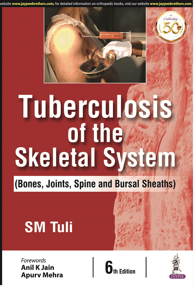 Tuberculosis of the Skeletal System (Bones, Joints, Spine and Bursal Sheaths) - Retail Maharaj