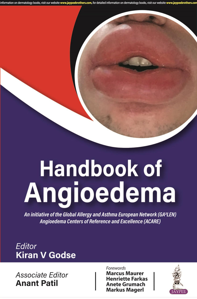 Handbook of Angioedema - Retail Maharaj