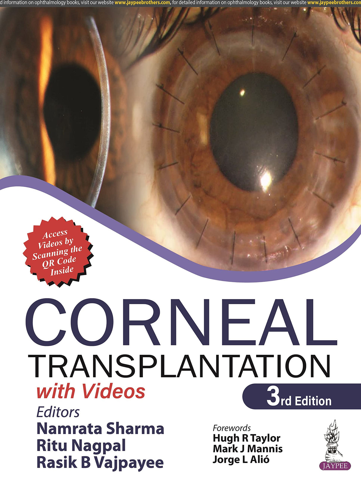 CORNEAL TRANSPLANTATION - Retail Maharaj