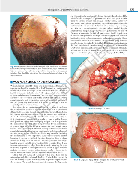 SRB'S SURGICAL OPERATION TEXT AND ATLAS (2 VOLS) - Retail Maharaj