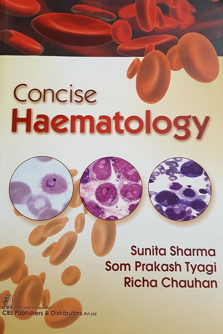 Concise Haematology (Pb 2018) - Retail Maharaj