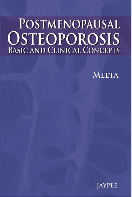 POSTMENOPAUSAL OSTEOPOROSIS BASIC & CLINICAL CONCEPTS - Retail Maharaj