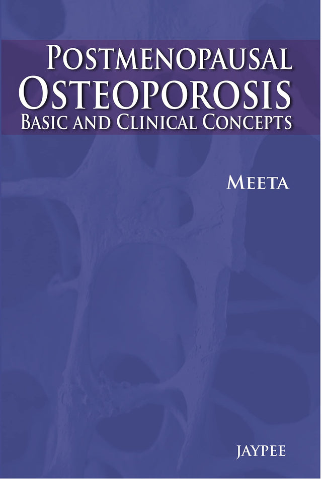 POSTMENOPAUSAL OSTEOPOROSIS BASIC & CLINICAL CONCEPTS - Retail Maharaj