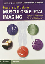 Pearls and Pitfalls in Musculoskeletal Imaging: Variants and Other Difficult Diagnoses - Retail Maharaj