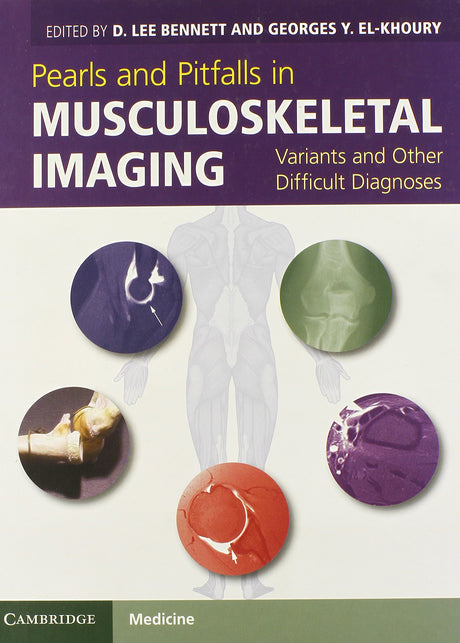 Pearls and Pitfalls in Musculoskeletal Imaging: Variants and Other Difficult Diagnoses - Retail Maharaj