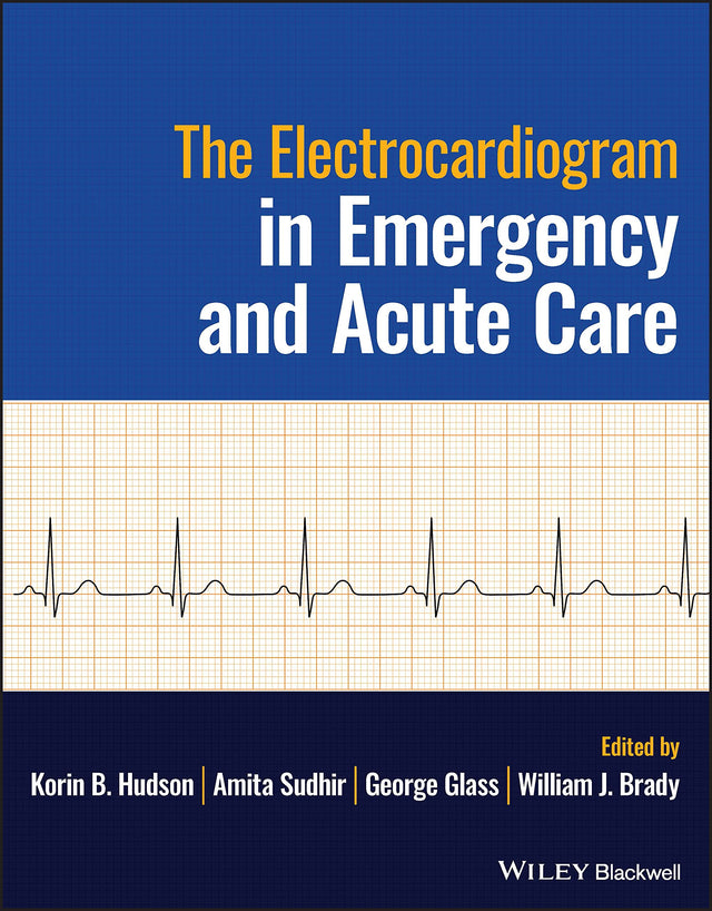 The Electrocardiagram in Emergency and Acute Care - Retail Maharaj