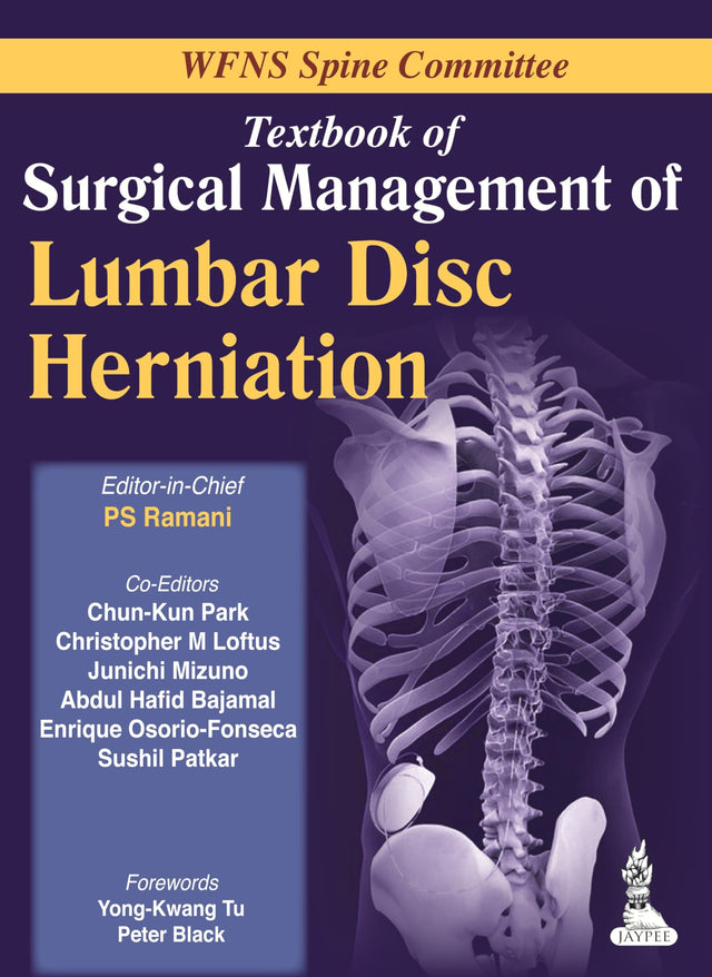 T.B.OF SURGICAL MANAGEMENT OF LUMBAR DISC HERNIATION WFNS SPINE COMMITTEE - Retail Maharaj