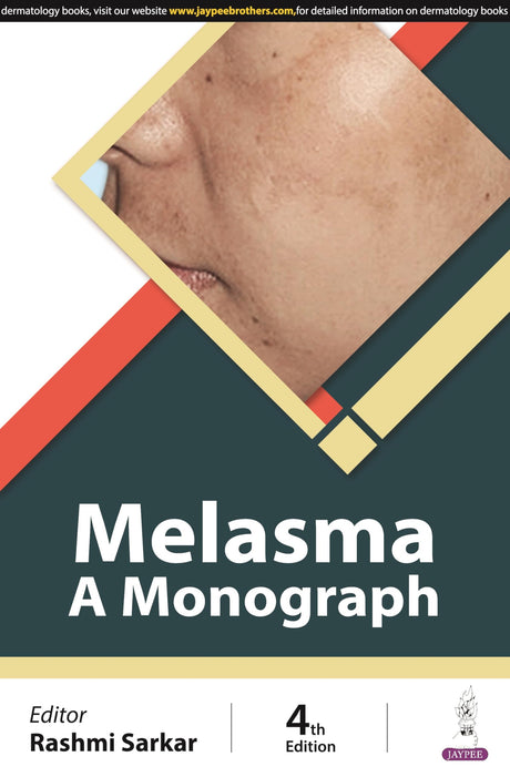 MELASMA: A MONOGRAPH - Retail Maharaj