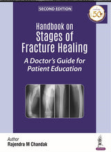 HANDBOOK ON STAGES OF FRACTURE HEALING A DOCTOR'S GUIDE FOR PATIENT EDUCATION - Retail Maharaj