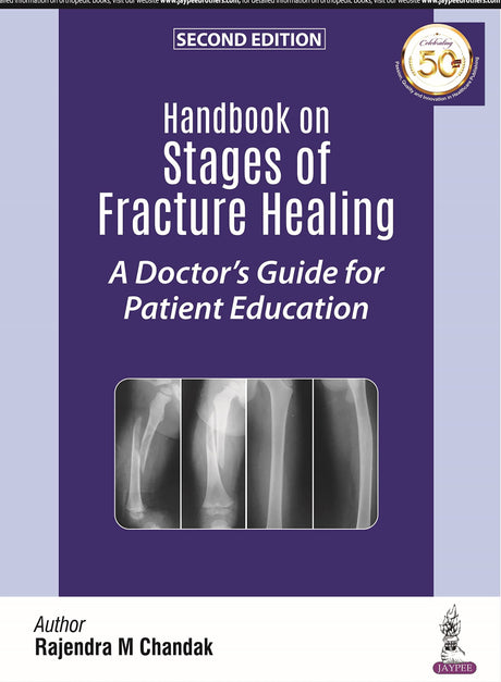 HANDBOOK ON STAGES OF FRACTURE HEALING A DOCTOR'S GUIDE FOR PATIENT EDUCATION - Retail Maharaj