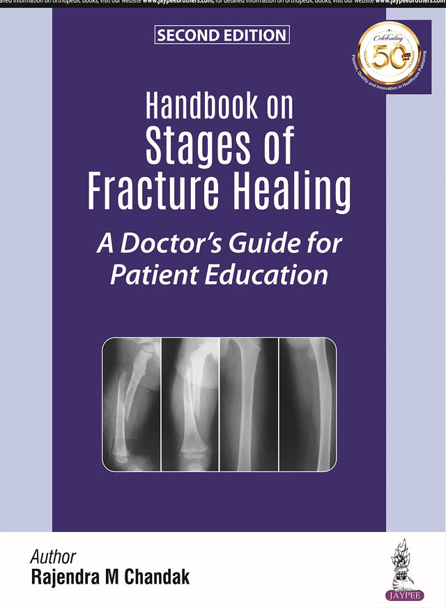 HANDBOOK ON STAGES OF FRACTURE HEALING A DOCTOR'S GUIDE FOR PATIENT EDUCATION - Retail Maharaj