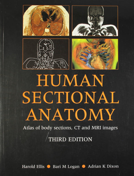 (OLD)HUMAN SECTIONAL ANATOMY ATLAS OF BODY SECTIONS, CT AND MRI IMAGES - Retail Maharaj
