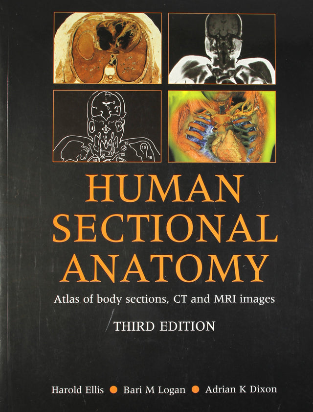 (OLD)HUMAN SECTIONAL ANATOMY ATLAS OF BODY SECTIONS, CT AND MRI IMAGES - Retail Maharaj
