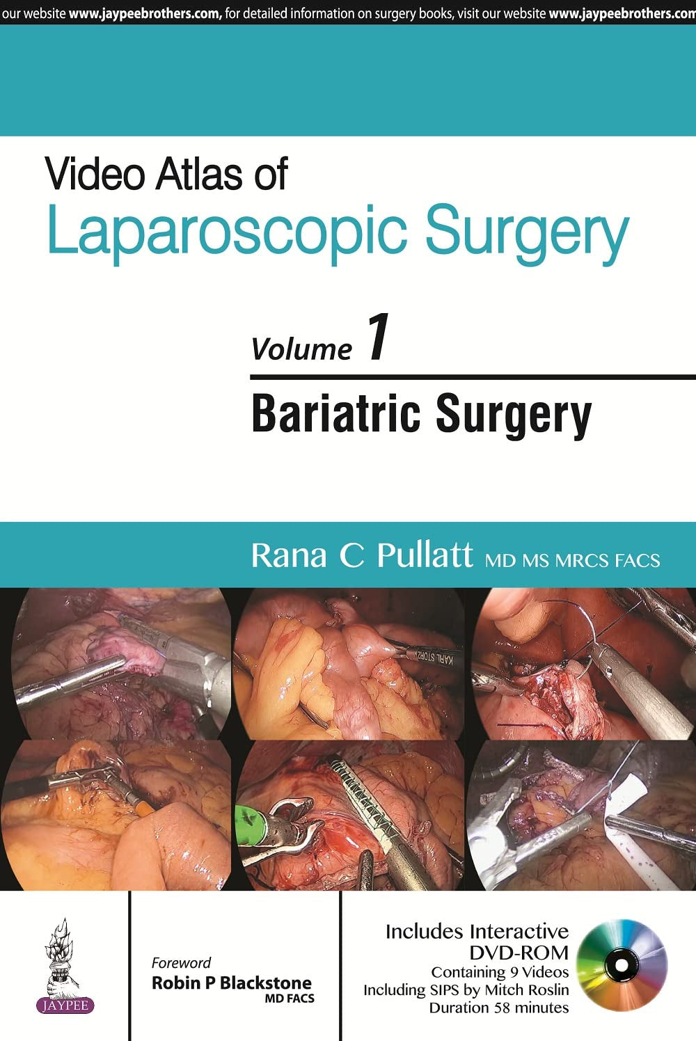 VIDEO ATLAS OF LAPAROSCOPIC SURGERY VOL.1 BARIATRIC SURGERY WITH DVD-ROM - Retail Maharaj