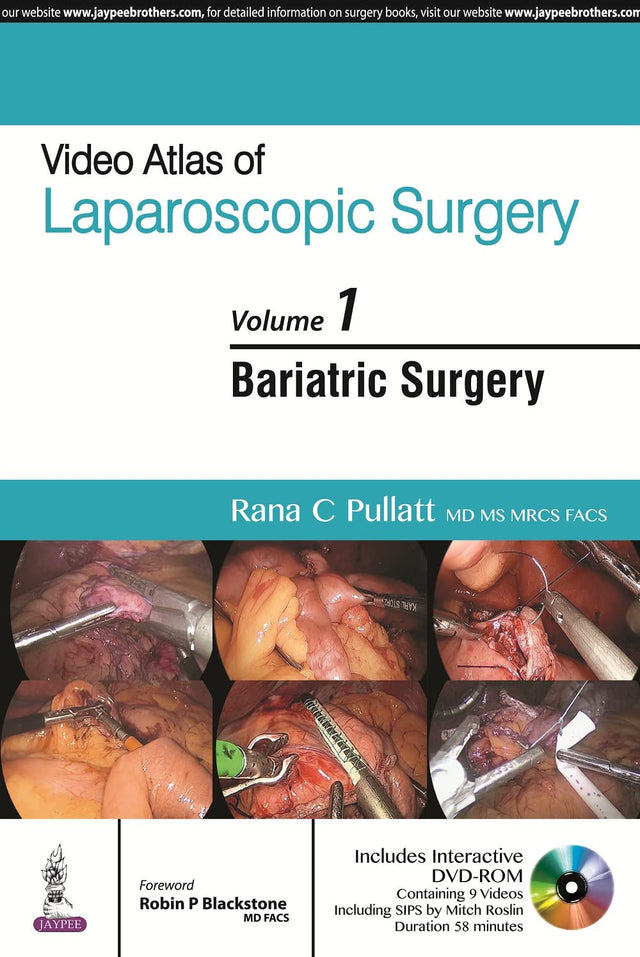 VIDEO ATLAS OF LAPAROSCOPIC SURGERY VOL.1 BARIATRIC SURGERY WITH DVD-ROM - Retail Maharaj