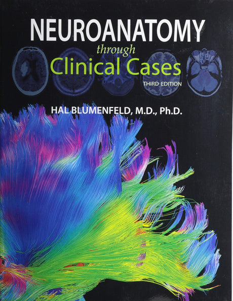 Neuroanatomy through Clinical Cases - Retail Maharaj