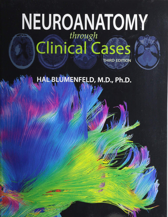 Neuroanatomy through Clinical Cases - Retail Maharaj