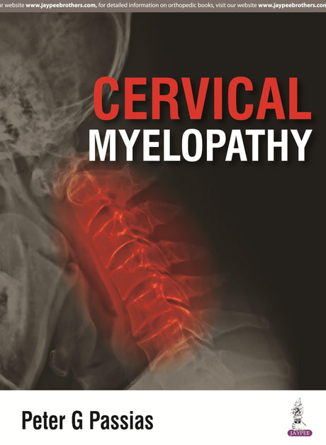 Cervical Myelopathy - Retail Maharaj