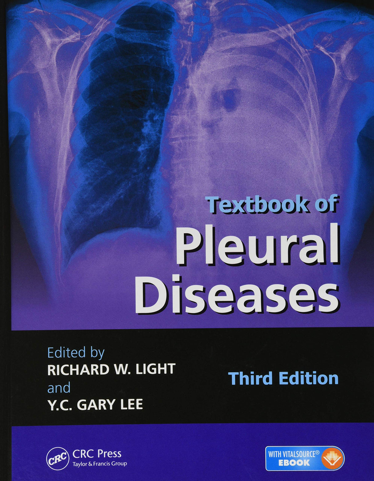 Textbook of Pleural Diseases - Retail Maharaj