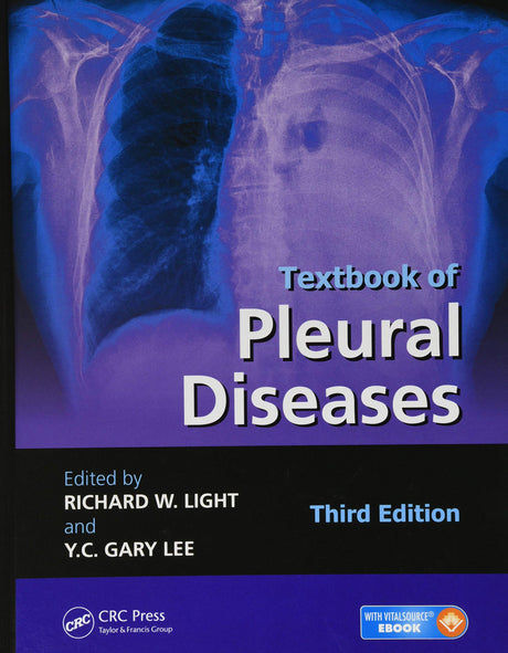Textbook of Pleural Diseases - Retail Maharaj