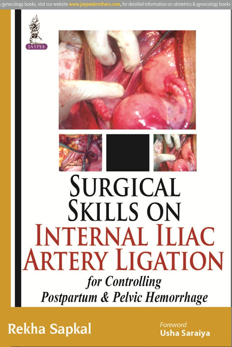 SURGICAL SKILLS ON INTERNAL ILIAC ARTERY LIGATION:FOR CONTROLLING POSTPARTUM & PELVIC HEMORRHAGE - Retail Maharaj