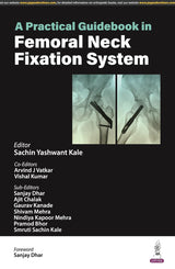 A PRACTICAL GUIDEBOOK IN FEMORAL NECK FIXATION SYSTEM - Retail Maharaj