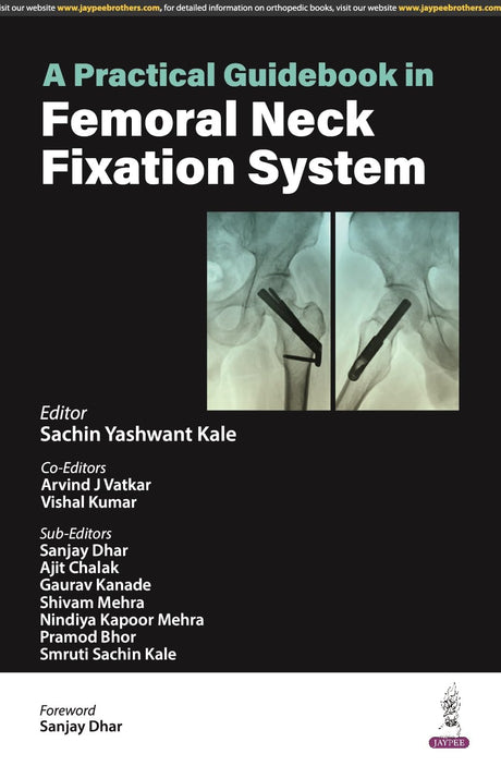A PRACTICAL GUIDEBOOK IN FEMORAL NECK FIXATION SYSTEM - Retail Maharaj