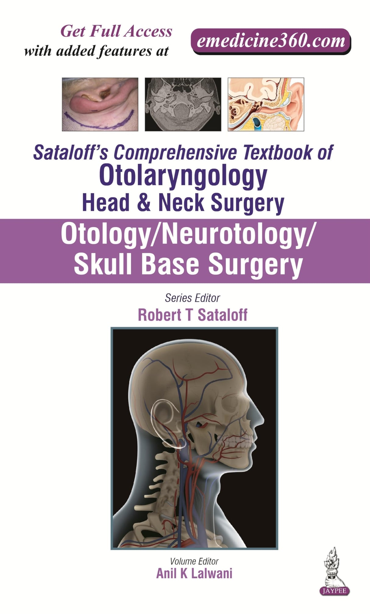 SATALOFF'S COMPREHENSIVE TB.OF OTOLARY.HEAD&NECK SURGERY OTOLOGY/NEUROTOLOGY/SKULL BASE SUR.VOL.1 - Retail Maharaj