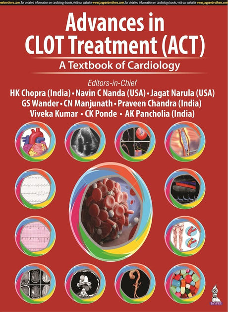 Advances in CLOT Treatment (ACT): A Textbook of Cardiology - Retail Maharaj