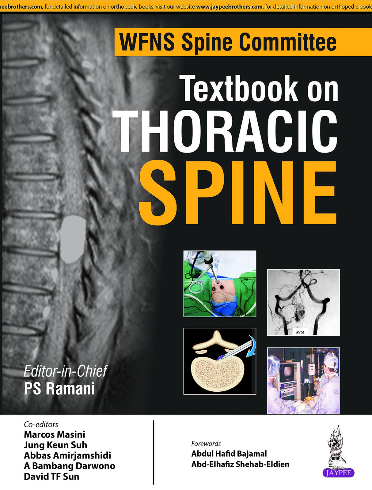 WFNS SPINE COMMITTEE TEXTBOOK ON THORACIC SPINE - Retail Maharaj
