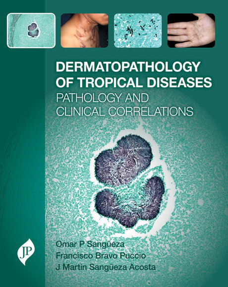Dermatopathology of Tropical Diseases Pathology and Clinical Correlations - Retail Maharaj