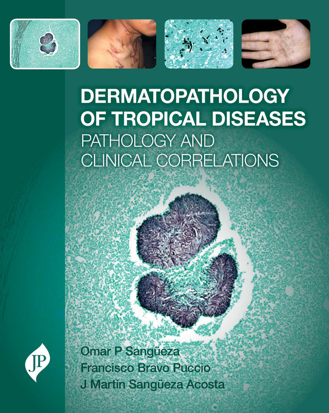 Dermatopathology of Tropical Diseases Pathology and Clinical Correlations - Retail Maharaj
