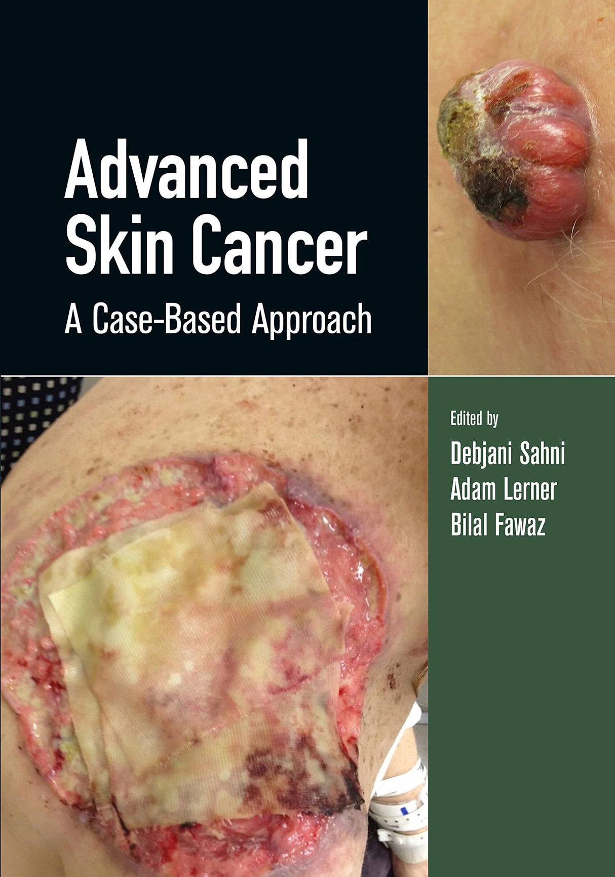 Advanced Skin Cancer 1st/2022 - Retail Maharaj