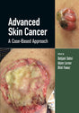 Advanced Skin Cancer 1st/2022 - Retail Maharaj