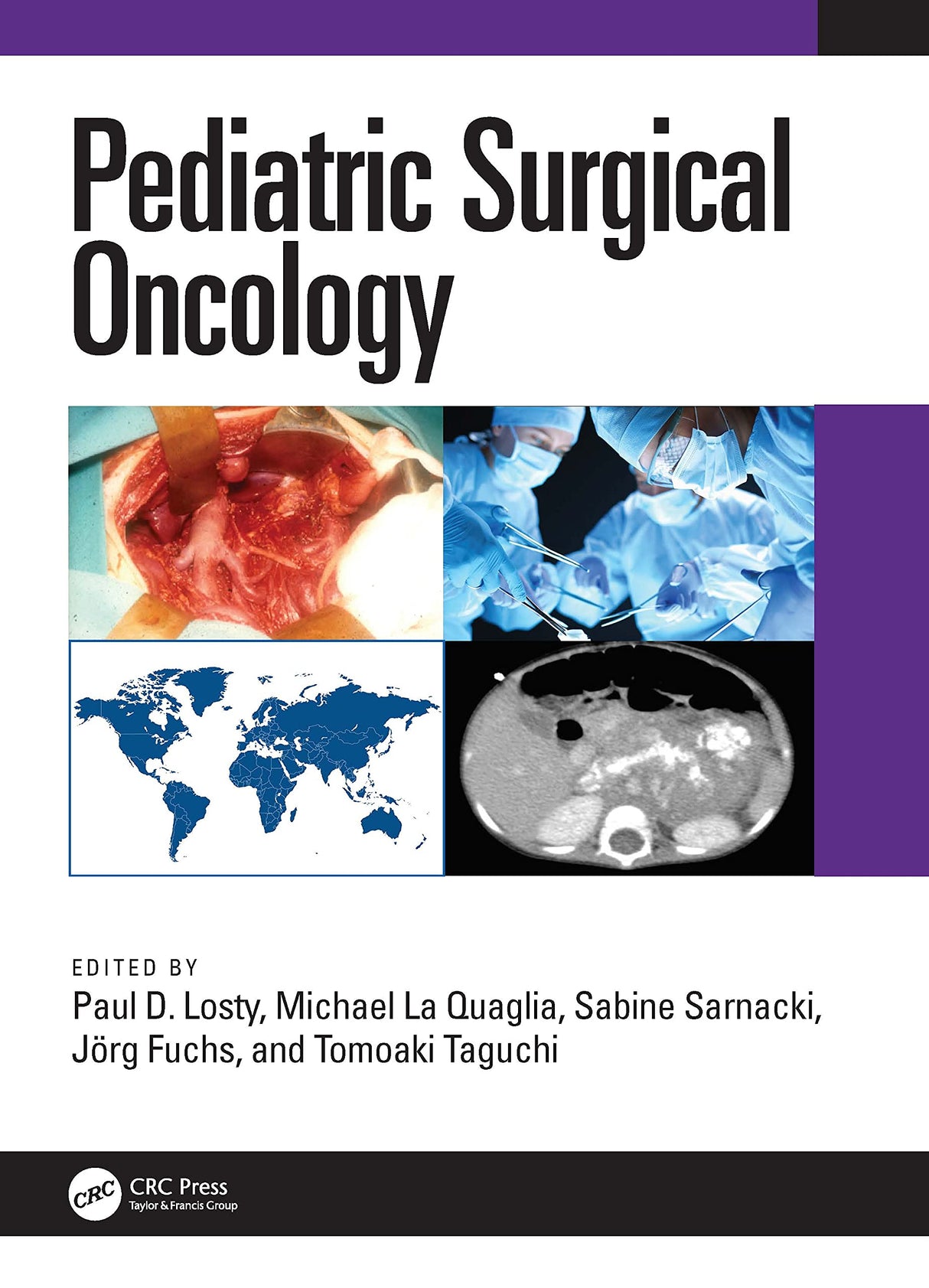 Pediatric Surgical Oncology 1st/2022 - Retail Maharaj