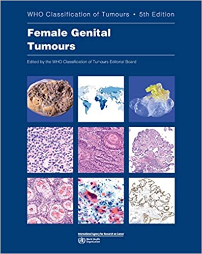 WHO Classification of Tumours: Female Genital Tumours 5th/2020 - Retail Maharaj