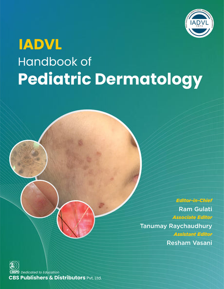 IADVL Handbook of Pediatric Dermatology 1st/2025 - Retail Maharaj