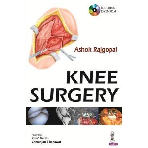 Knee Surgery Includes DVD-ROM - Retail Maharaj