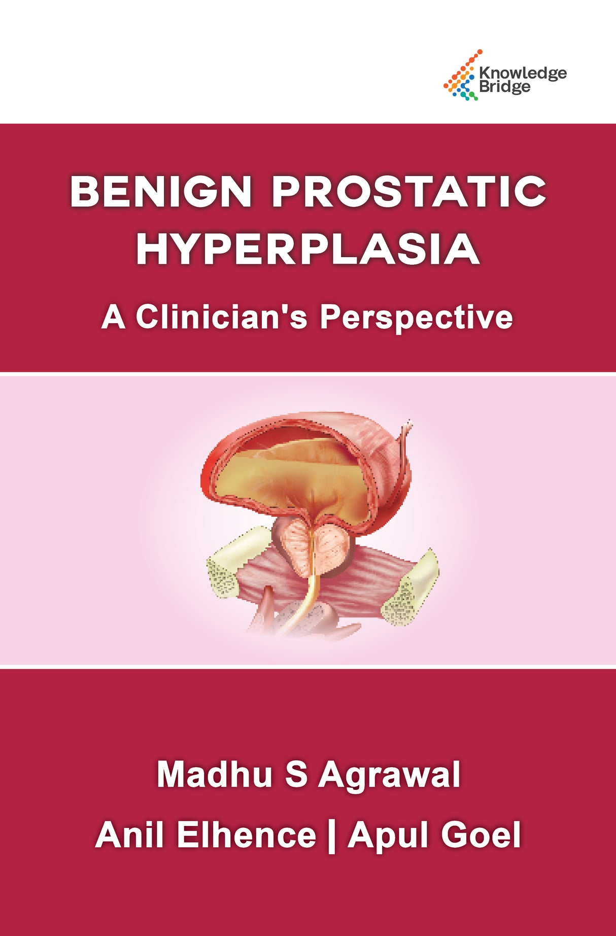 Benign Prostatic Hypertrophy A Clinician's Perspective 1st/2022 - Retail Maharaj