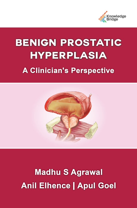 Benign Prostatic Hypertrophy A Clinician's Perspective 1st/2022 - Retail Maharaj