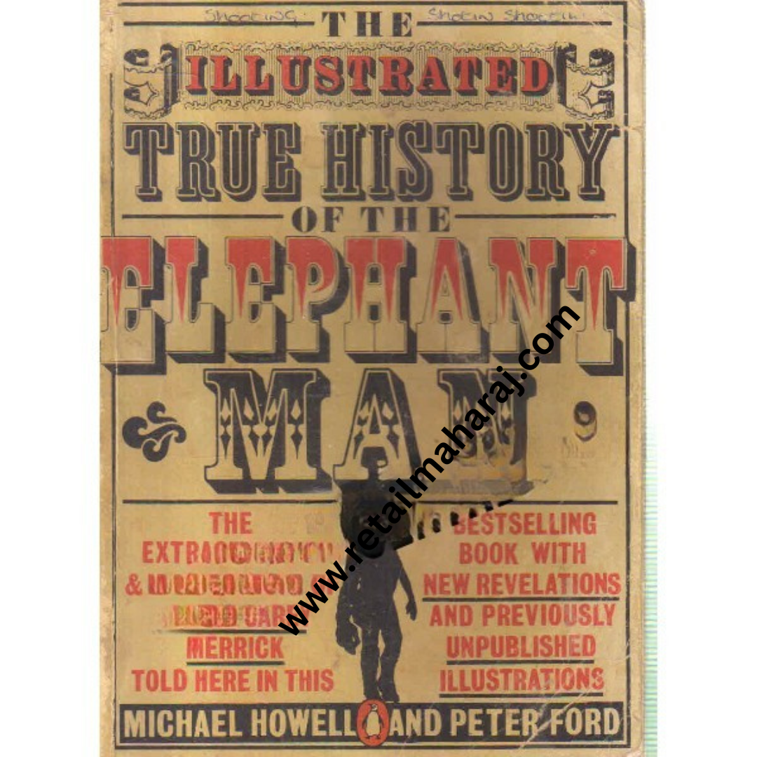true history of the elephant man