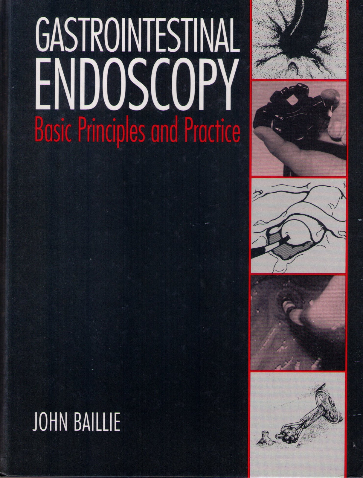 Gastrointestinal Endoscopy: Basic Principles and Practice - Retail Maharaj