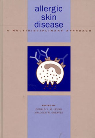 Allergic Skin Disease: A Multidisciplinary Approach - Retail Maharaj