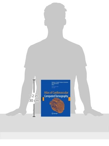 Atlas of Cardiovascular Computed Tomography - Retail Maharaj